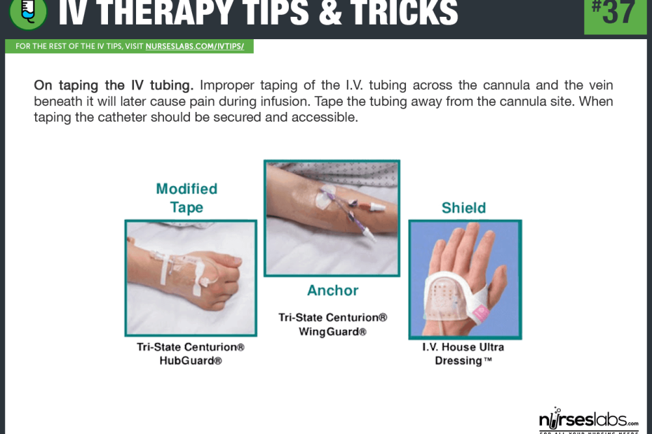 How To Start An Iv? 50+ Tips On Iv Insertion, Rolling Veins (2020 Update)